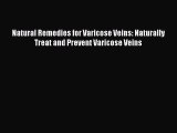 Read Natural Remedies for Varicose Veins: Naturally Treat and Prevent Varicose Veins Ebook