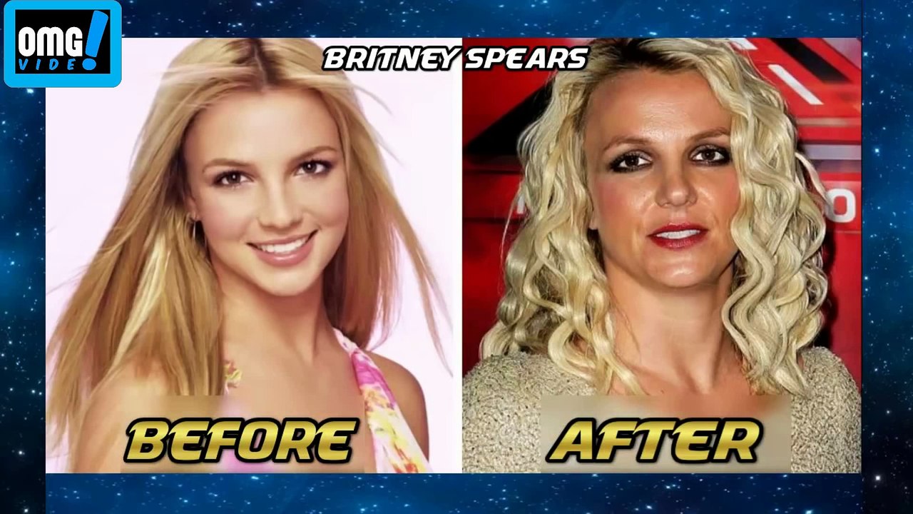 OMG!!! Famous Before And After 2016