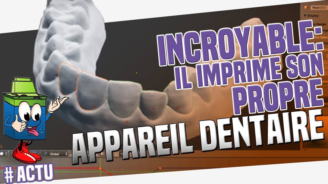 Impression 3D : un étudiant s'imprime son propre appareil