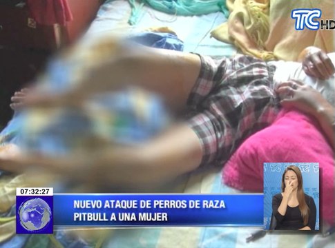 Perros atacan a mujer en Santo Domingo de los Tsáchilas