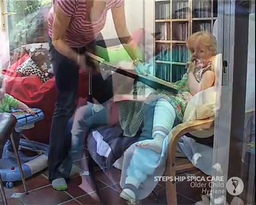 Hip Spica-Older-Child-Hygiene.mp4
