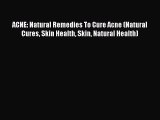 Read ACNE: Natural Remedies To Cure Acne (Natural Cures Skin Health Skin Natural Health) Ebook