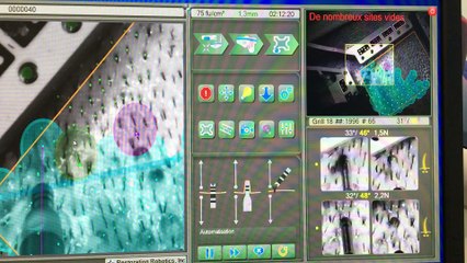 2000 greffons prelevements en 2h12 mn