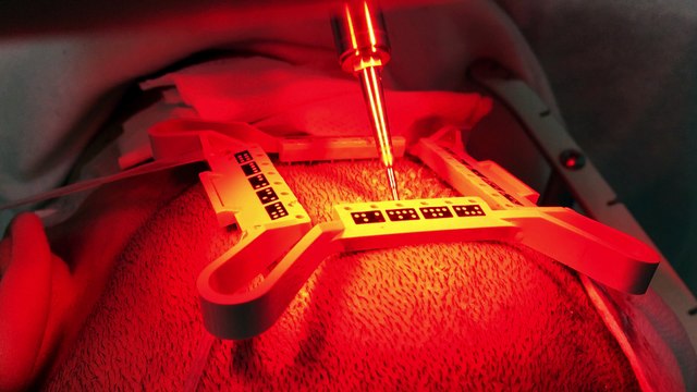 Zoom prelevement ARTAS