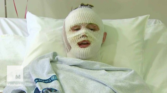 American teen who survived Brussels tells harrowing account of airport attack