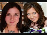 Bilder von Mädchen, die vor und nach dem make-up Vor und Nach dem Make-up