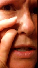 Morgellons Parasite Exiting Side of Nose (After Using Magnetic Vibrator)