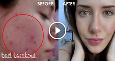 How To Cover Acne & Scars (IF You Want To) _ Easy Makeup Transformation Routine
