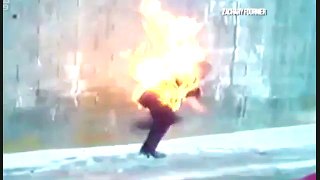 Pittsburgh teen sets himself on fire playing with gasoline