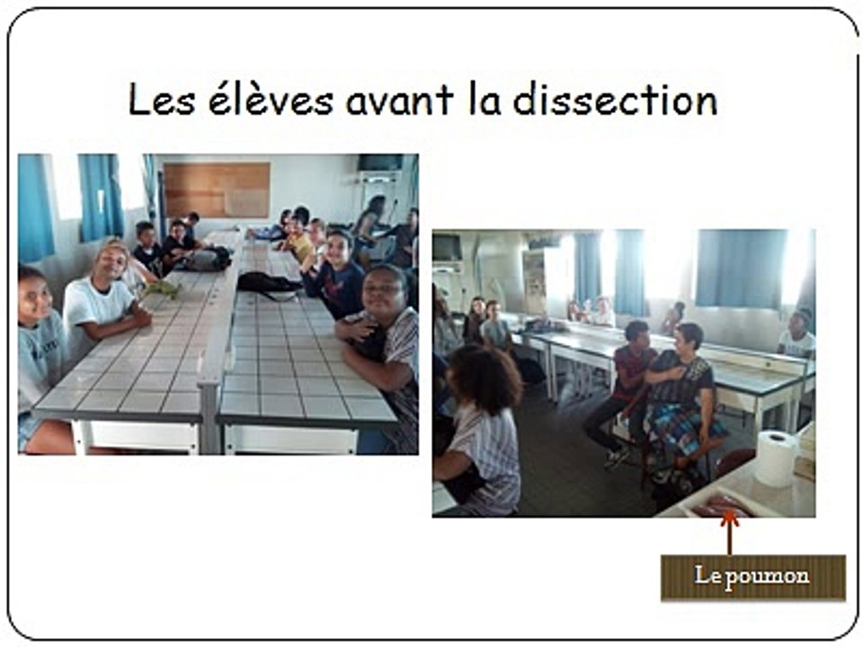 Dissection d’un poumon