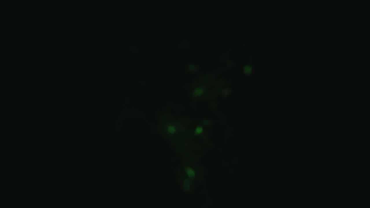 Project Cars PS4 | Cadwell Park Club Circuit | Ford Escort RS 1600 MkI