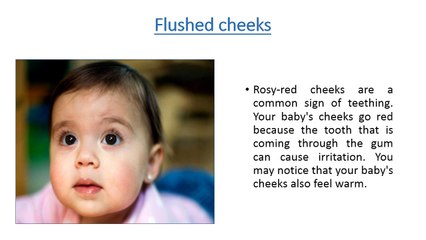 Signs of teething