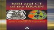 Download MRI and CT of the Brain