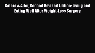 Read Before & After Second Revised Edition: Living and Eating Well After Weight-Loss Surgery