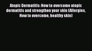 Read Atopic Dermatitis: How to overcome atopic dermatitis and strengthen your skin (Allergies