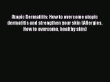 Read Atopic Dermatitis: How to overcome atopic dermatitis and strengthen your skin (Allergies