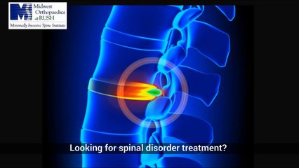 Find Orthopedic Surgeon Chicago Il - Outpatient-spine-surgeon.com