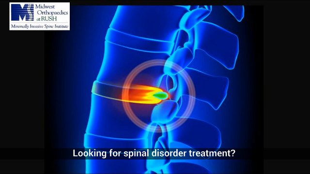 Find Orthopedic Surgeon Chicago Il - Outpatient-spine-surgeon.com