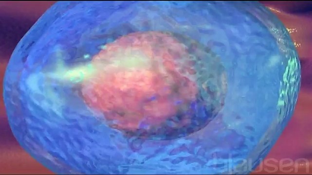 Down Sendromu - Hemen Sağlık