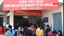 Hàng trăm trẻ em dị tật được phẫu thuật miễn phí.