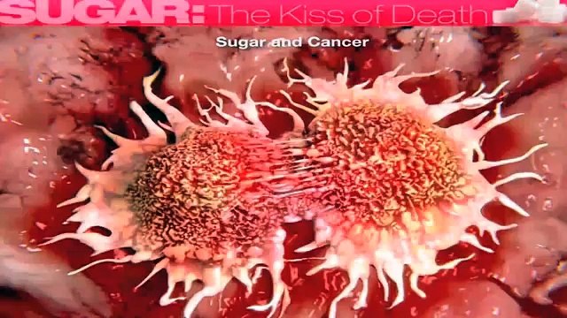 Brian Clement of Hippocrates Health Institute lectures on Sugar - Brian Clement 35