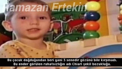 Dünyanın En ilginç Doğan 10 Bebeği