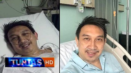 Kondisi Augie Fantinus Pasca Dikateter - Tuntas 31 Maret 2016