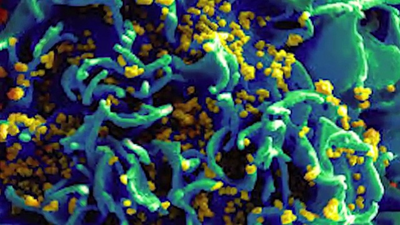 Top 10 Interesting Facts About HIV