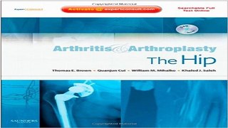Download Arthritis and Arthroplasty  The Hip  Expert Consult   Online  Print and DVD  1e