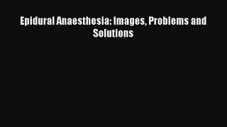 Read Epidural Anaesthesia: Images Problems and Solutions PDF Online