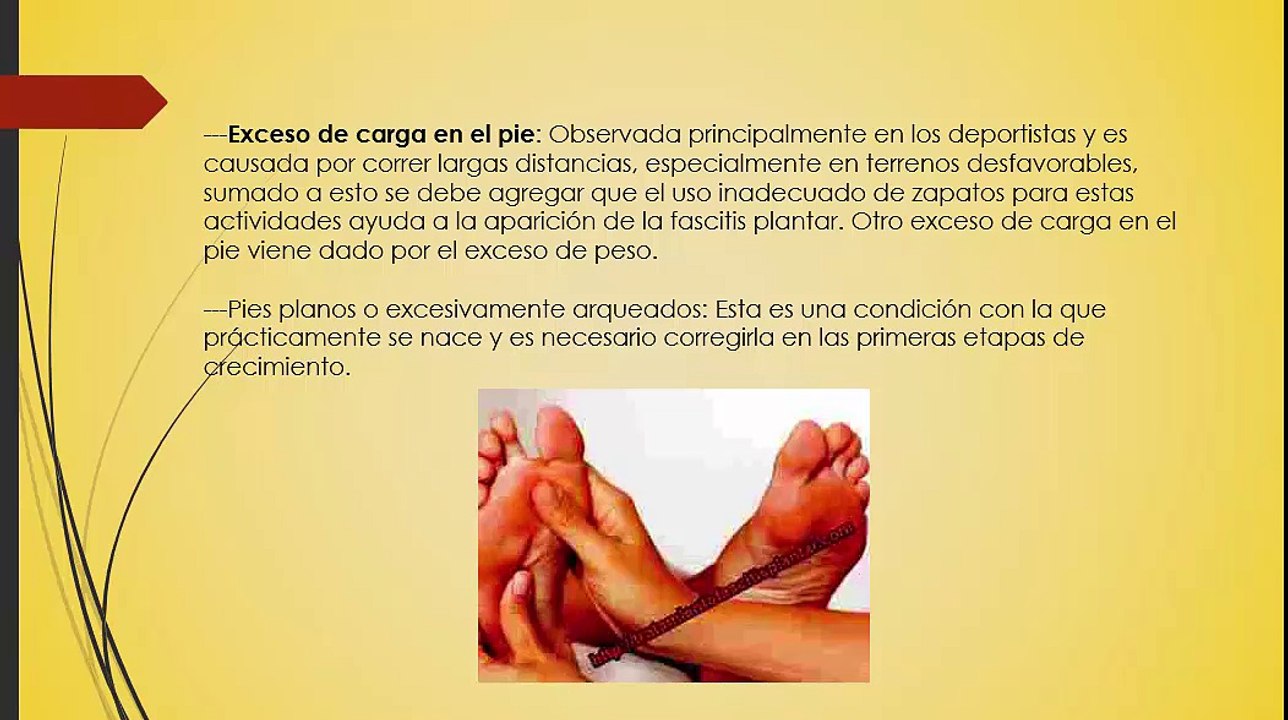Tratamiento para Fascitis Plantar. Secretos Revelados