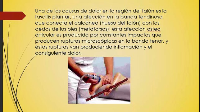 La fascitis plantar, causas, localización del dolor, síntomas y prevención
