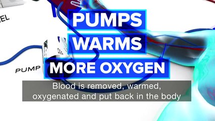 Man frozen to death comes back to life - BBC News