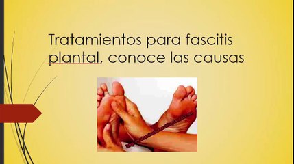 Tratamientos para fascitis plantal, conoce las causas