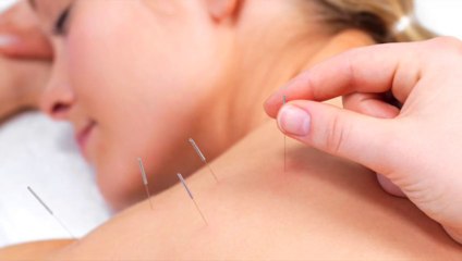 Acupuncturist Mississauga ON