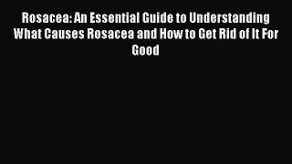 Read Rosacea: An Essential Guide to Understanding What Causes Rosacea and How to Get Rid of