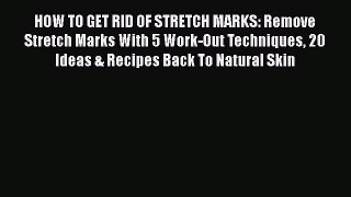 Read HOW TO GET RID OF STRETCH MARKS: Remove Stretch Marks With 5 Work-Out Techniques 20 Ideas