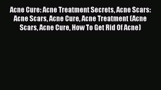 Read Acne Cure: Acne Treatment Secrets Acne Scars: Acne Scars Acne Cure Acne Treatment (Acne