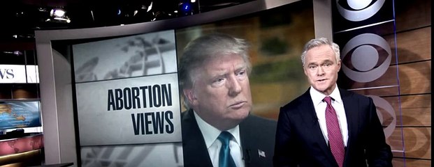 Donald Trump: Don't change abortion laws