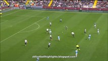 1-1 Gonzalo Higuaín Amazing Goal HD - Udinese 1 - 1 Napoli 03-04-2016