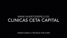 CLINICAS CETA CAPITAL www.injertodepelo.es
