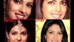 Bollywood Beauties And Their Plastic Surgeries