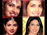 Bollywood Beauties And Their Plastic Surgeries