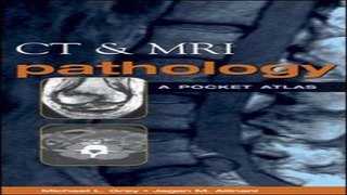 Download CT   MRI Pathology  A Pocket Atlas