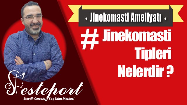 Jinekomasti Olma Tipleri Nelerdir