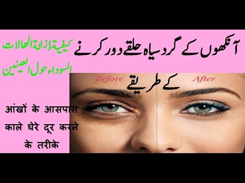 aankhon ke gird siah halqe blackness around eyes