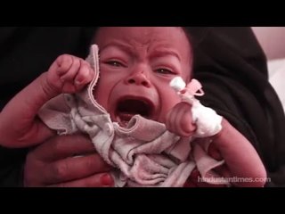 The heartbreaking story behind this starving baby