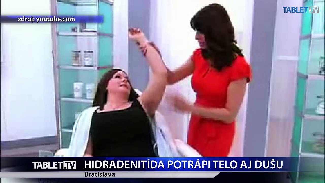 Diagnostika hidradenitídy trvá v priemere osem rokov 