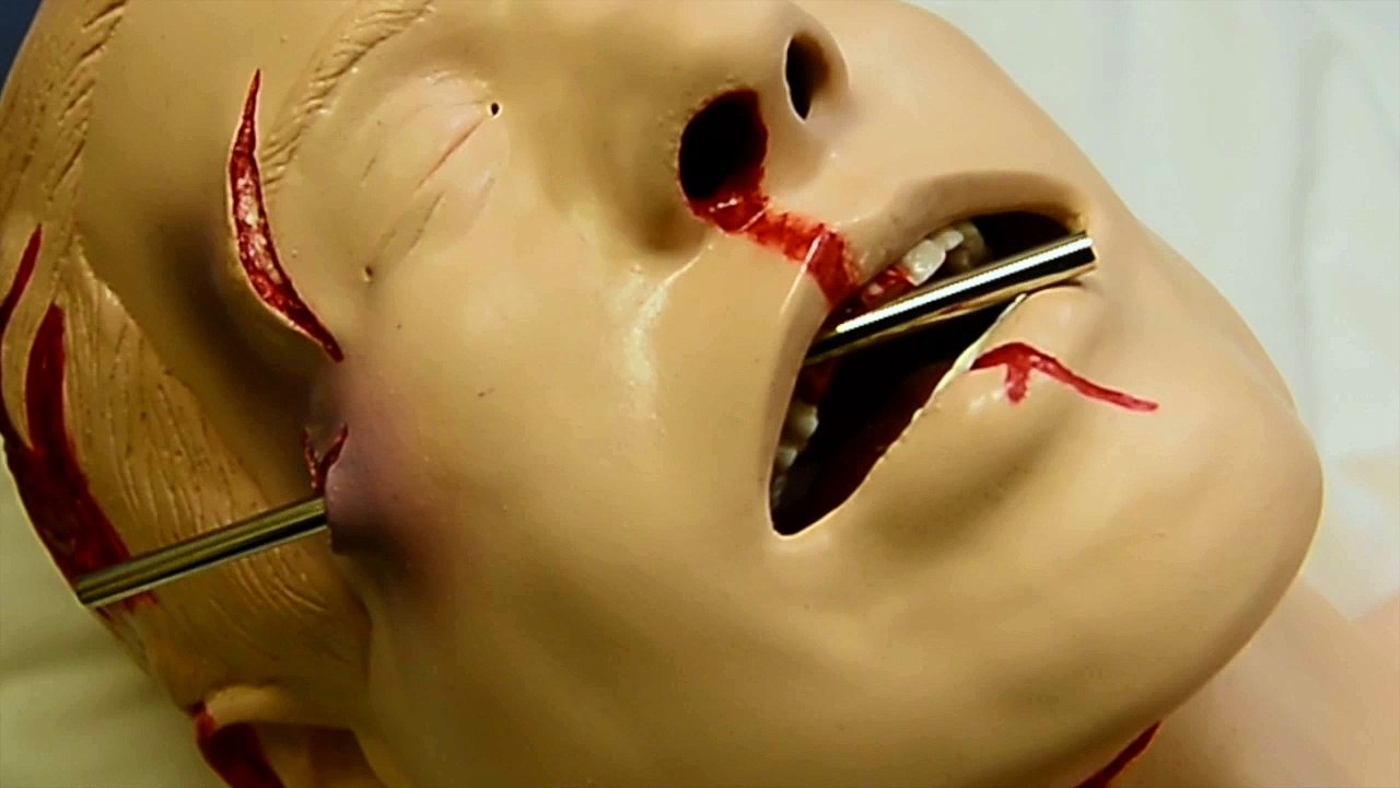 Bruxelles, CHU Saint-Pierre, mannequin traumatisé pour cours préventifs face aux catastrophes et accidents graves.