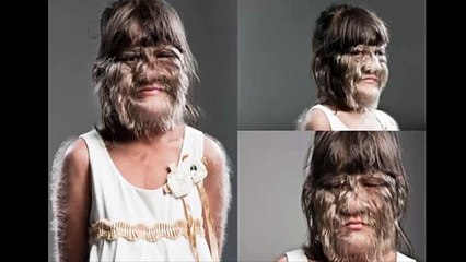 guinness world record holder Hairiest teenager in the world